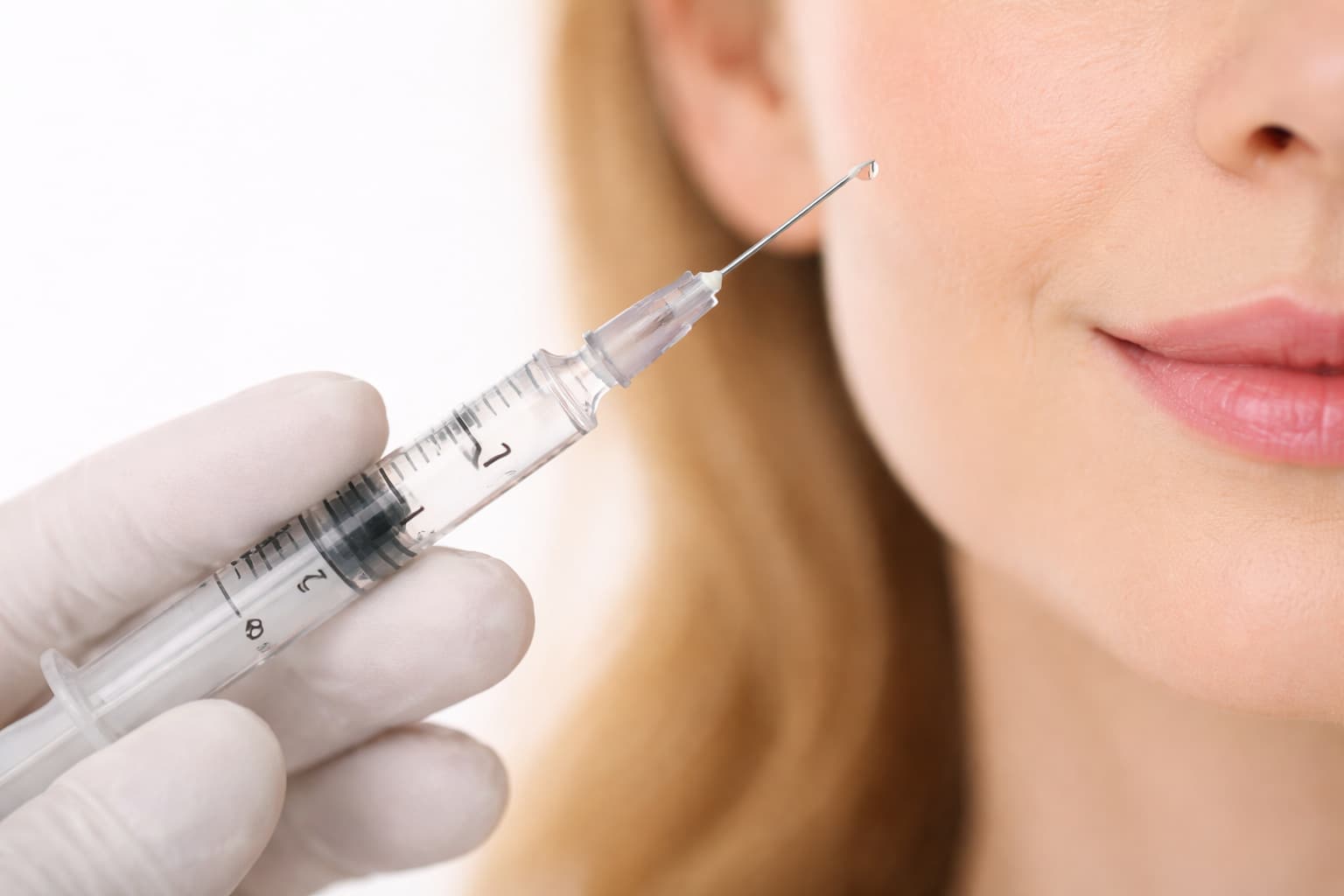 Aplicação de toxina botulínica realizada por biomédica especialista